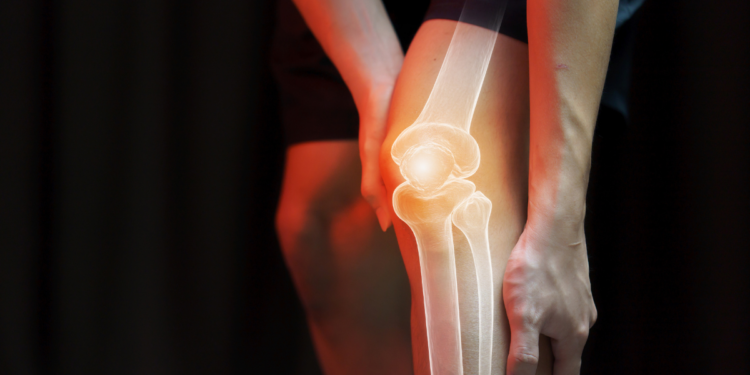 Stiff joints and diet